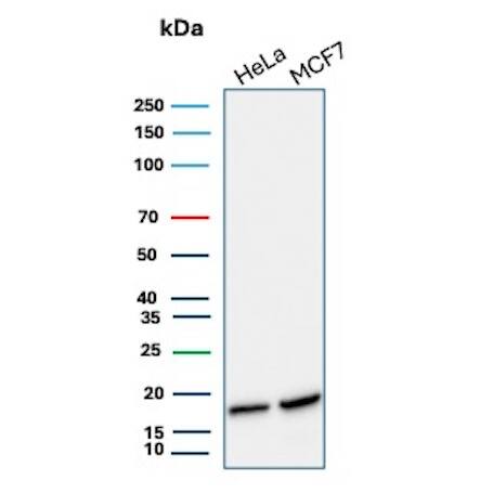 NM23-H2/NME2 Antibody (NME2/6435) - Azide and BSA Free Western Blot: NM23-H2/NME2 Antibody (NME2/6435) - Azide and BSA Free [NBP3-20732] -