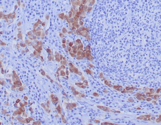 ROS Antibody (ROS1/7999R) - Azide and BSA Free