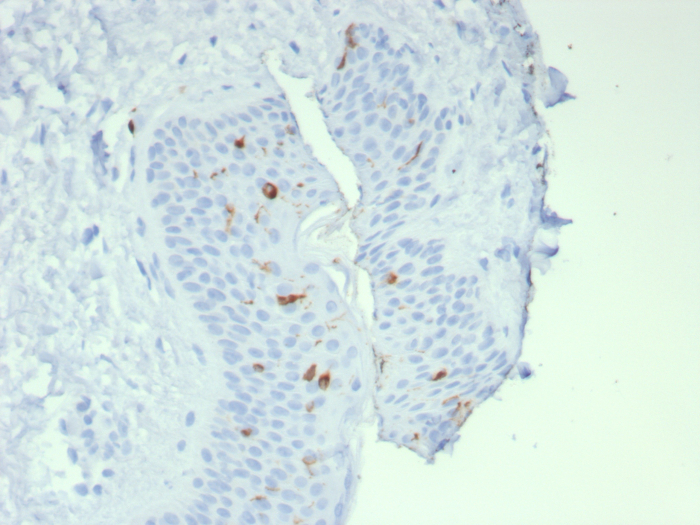 Langerin/CD207 Antibody (LGRN/7541) - Azide and BSA Free