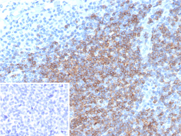 CD5 Antibody (rC5/6976) - Azide and BSA Free