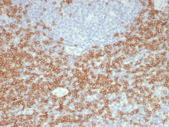 CD5 Antibody (C5/8117R) - Azide and BSA Free