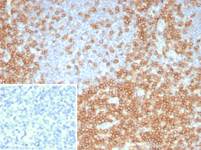 CD5 Antibody (C5/8117R) - Azide and BSA Free