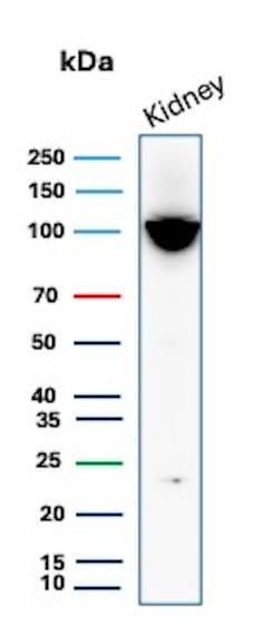 Neprilysin/CD10 Antibody (MME/6696R) - Azide and BSA Free Western Blot: Neprilysin/CD10 Antibody (MME/6696R) - Azide and BSA Free [NBP3-20765] -