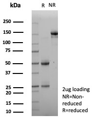 KIF2C Antibody (KIF2C/4705) - Azide and BSA Free