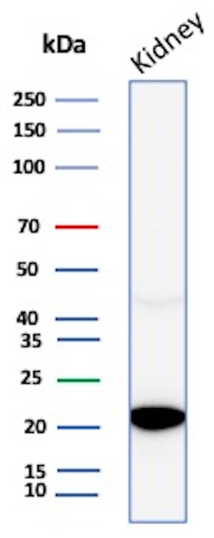 AlphaB Crystallin/CRYAB Antibody (CRYAB/4663) - Azide and BSA Free Western Blot: AlphaB Crystallin/CRYAB Antibody (CRYAB/4663) - Azide and BSA Free [NBP3-20769] -