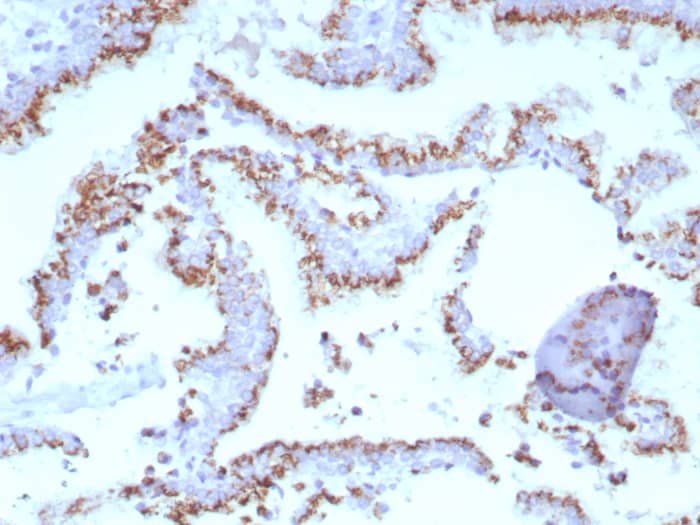 SLC45A3/Prostein Antibody (SLC45A3/7647) - Azide and BSA Free Immunohistochemistry-Paraffin: SLC45A3/Prostein Antibody (SLC45A3/7647) - Azide and BSA Free [NBP3-20790] -