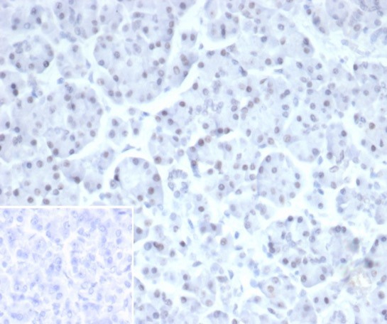 PHOX2B Antibody (PHOX2B/7792R) - Azide and BSA Free