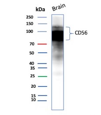 NCAM-1/CD56 Antibody (rNCAM1/8655) - Azide and BSA Free Western Blot: NCAM-1/CD56 Antibody (rNCAM1/8655) - Azide and BSA Free [NBP3-20806] -