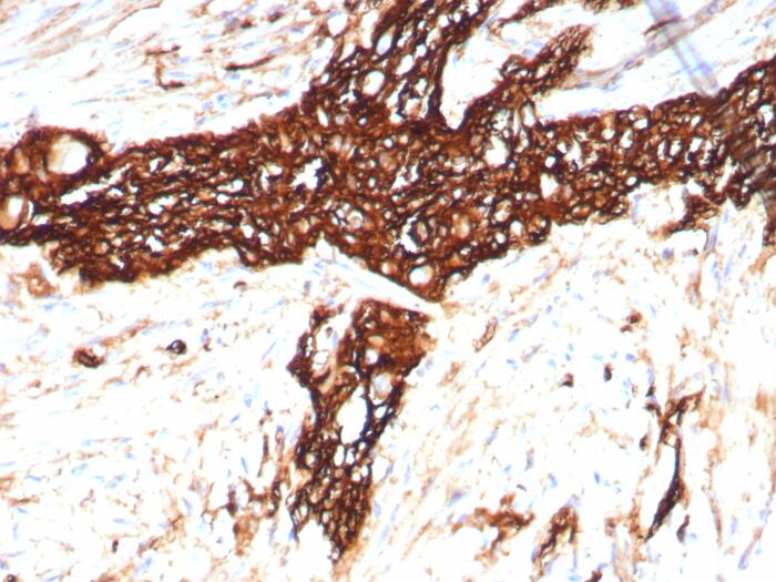 NCAM-1/CD56 Antibody (rNCAM1/8758) - Azide and BSA Free NCAM-1/CD56 Antibody (rNCAM1/8758) - Azide and BSA Free