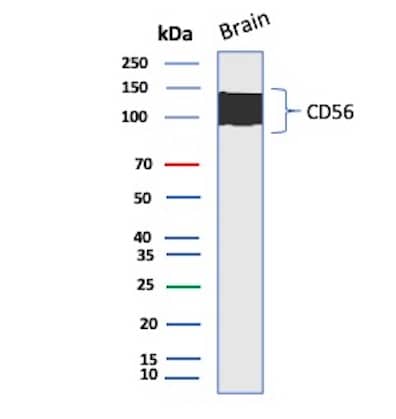 NCAM-1/CD56 Antibody (rNCAM1/8758) - Azide and BSA Free Western Blot: NCAM-1/CD56 Antibody (rNCAM1/8758) - Azide and BSA Free [NBP3-20807] -