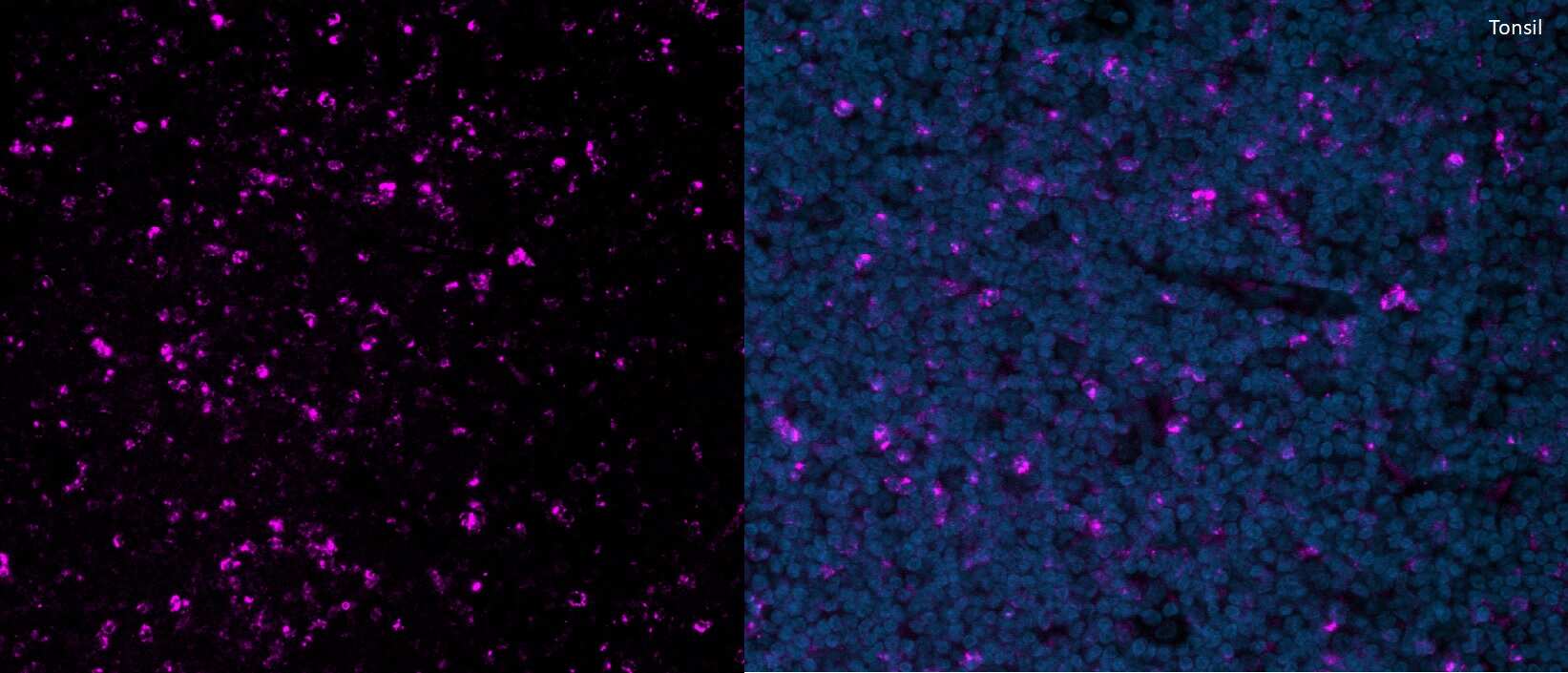 CTLA-4 Antibody (rCTLA4/7219) [Alexa Fluor® 647]