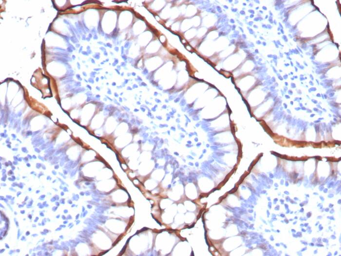 ACE-2 Antibody (ACE2/8748R) - Azide and BSA Free ACE-2 Antibody (ACE2/8748R) - Azide and BSA Free