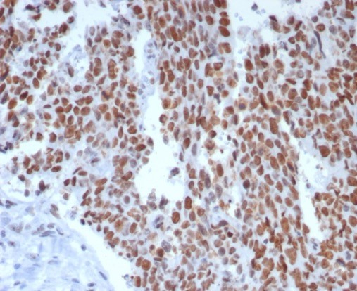 MSH6 Antibody (rMSH6/8181) - Azide and BSA Free