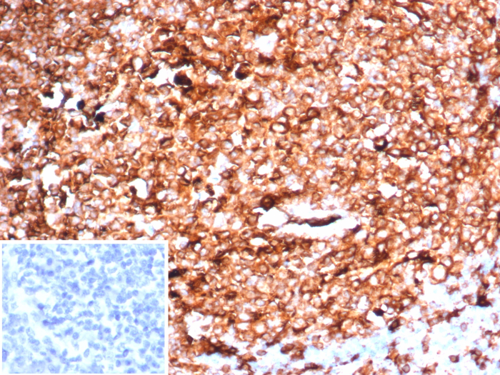 HLA-DR Antibody (HLA-DRA/6840R) - Azide and BSA Free