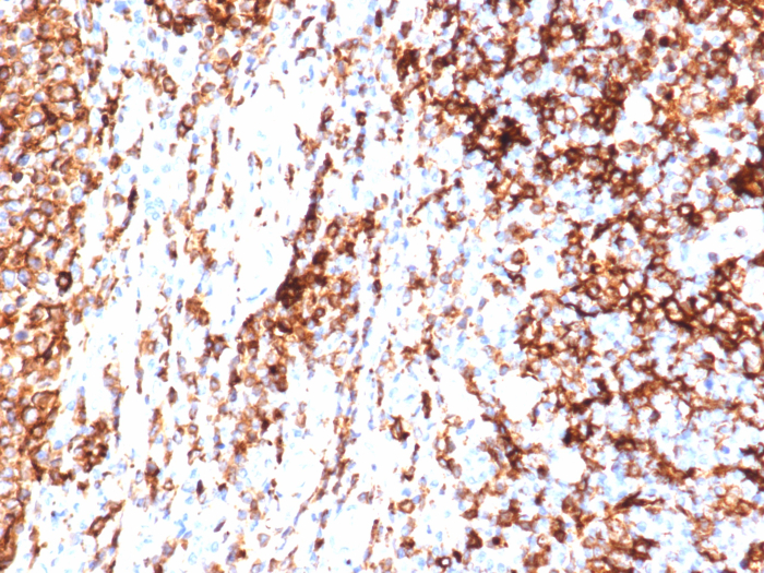 HLA-DR Antibody (HLA-DRA/6840R) - Azide and BSA Free