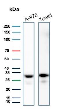 HLA-DR Antibody (HLA-DRA/6840R) - Azide and BSA Free Western Blot: HLA-DR Antibody (HLA-DRA/6840R) - Azide and BSA Free [NBP3-20837] -
