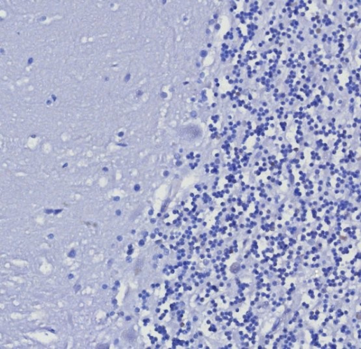 Cytokeratin 5/6 Antibody (KRT5.6/8275R) - Azide and BSA Free