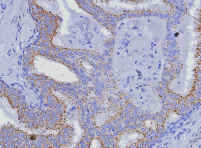 alpha-Methylacyl-CoA Racemase/AMACR Antibody (AMACR/8350R) - Azide and BSA Free