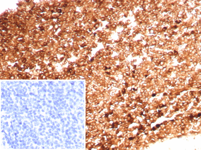Ferritin Heavy Chain Antibody (FTH/8700R) - Azide and BSA Free