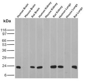 Ferritin Heavy Chain Antibody (FTH/8700R) - Azide and BSA Free Western Blot: Ferritin Heavy Chain Antibody (FTH/8700R) - Azide and BSA Free [NBP3-20850] -