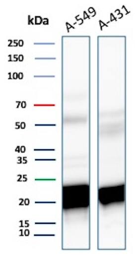 Ferritin Heavy Chain Antibody (FTH/8700R) - Azide and BSA Free Western Blot: Ferritin Heavy Chain Antibody (FTH/8700R) - Azide and BSA Free [NBP3-20850] -