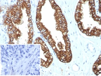 Cytokeratin 8/18 Antibody (KRT8.18/4997R) - Azide and BSA Free