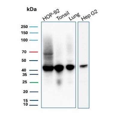 HLA ABC Antibody (MHC-I/8366R) - Azide and BSA Free Western Blot: HLA ABC Antibody (MHC-I/8366R) - Azide and BSA Free [NBP3-20856] -