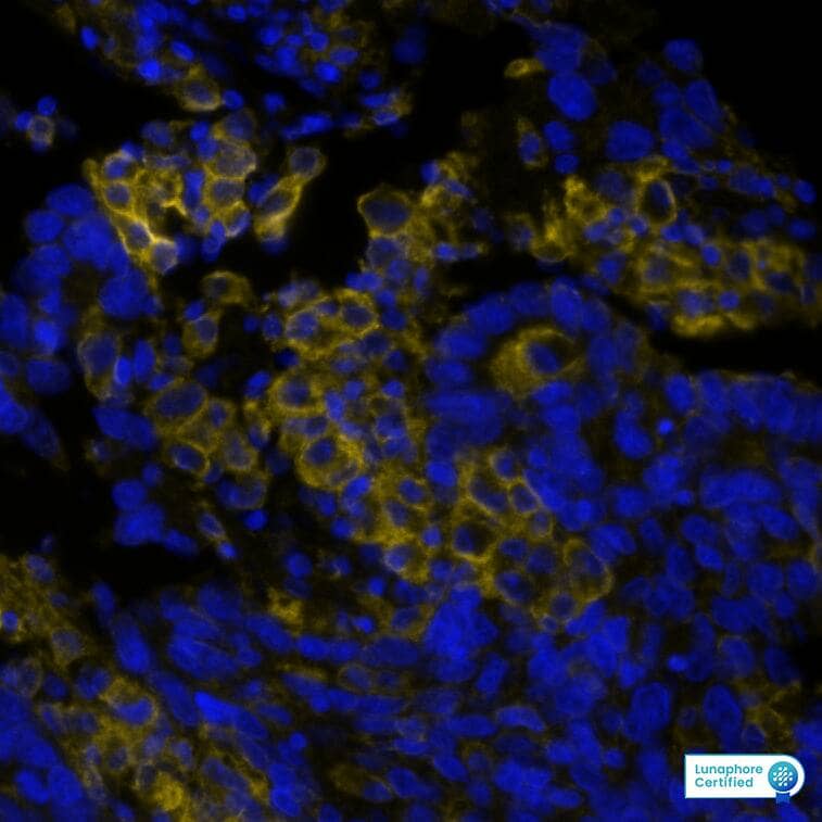 PD-L1 Antibody (PDL1/8809R) PD-L1 Antibody (PDL1/8809R) PD-L1 in Human Lung Tumor via seqIF� staining on COMET�