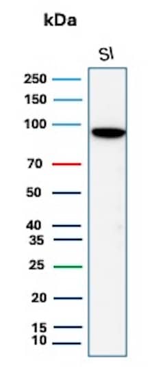 Cadherin-17 Antibody (rCDH17/8514) - BSA Free Western Blot: Cadherin-17 Antibody (rCDH17/8514) - BSA Free [NBP3-20889] -