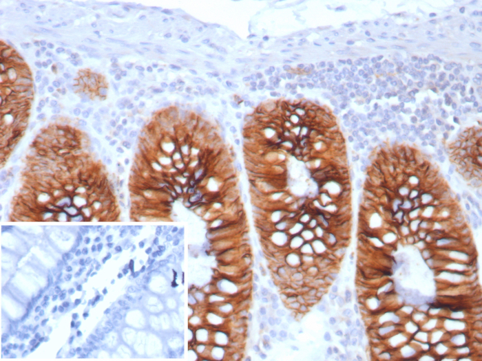 Cadherin-17 Antibody (CDH17/8513R) - BSA Free