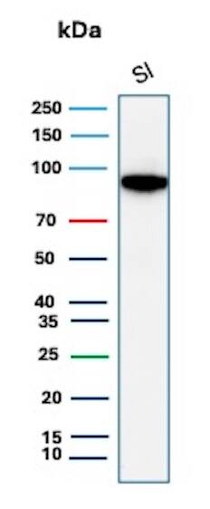 Cadherin-17 Antibody (CDH17/8513R) - BSA Free Western Blot: Cadherin-17 Antibody (CDH17/8513R) - BSA Free [NBP3-20890] -