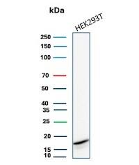 p16INK4a/CDKN2A Antibody (rCDKN2A/8004) - Azide and BSA Free Western Blot: p16INK4a/CDKN2A Antibody (rCDKN2A/8004) - Azide and BSA Free [NBP3-20898] -