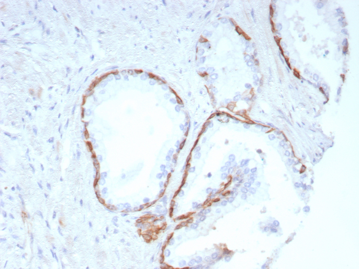 Cytokeratin 14 Antibody (KRT14/8691R) - Azide and BSA Free