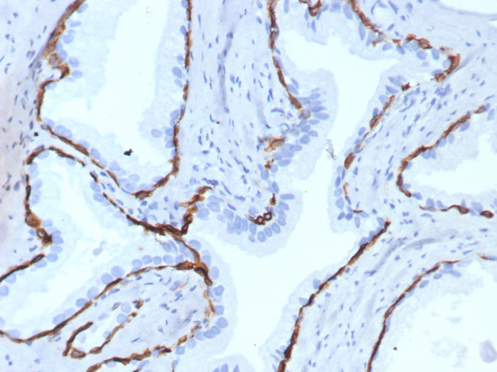 Cytokeratin 14 Antibody (KRT14/7977R) - Azide and BSA Free