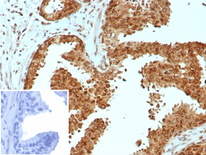 Carm1 Antibody (CARM1/7426) - Azide and BSA Free