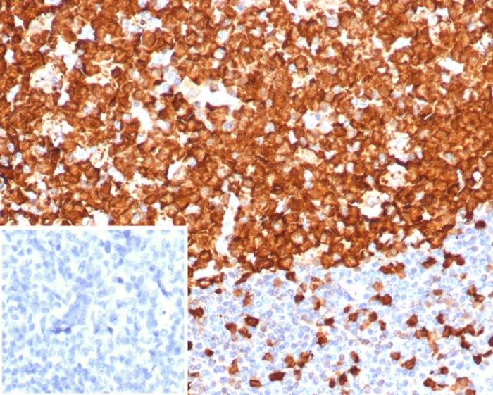 Stathmin 1 Antibody (STMN1/8001R) - Azide and BSA Free