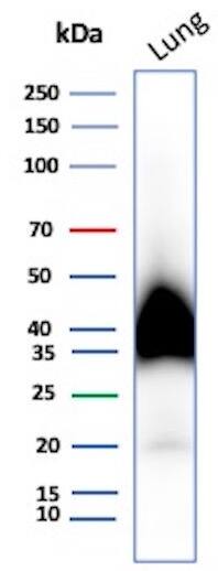 Podoplanin Antibody (PDPN/7808R) - Azide and BSA Free Western Blot: Podoplanin Antibody (PDPN/7808R) - Azide and BSA Free [NBP3-20918] -