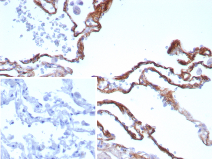 Periostin/OSF-2 Antibody (rPOSTN/8522) - Azide and BSA Free