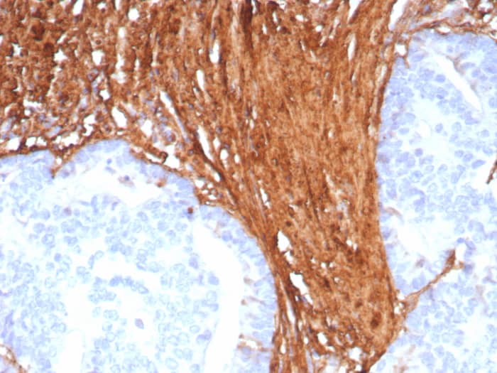 Periostin/OSF-2 Antibody (POSTN/8523R) - Azide and BSA Free Periostin/OSF-2 Antibody (POSTN/8523R) - Azide and BSA Free