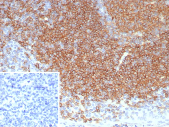 Siglec-2/CD22 Antibody (BLCAM/8113R) - Azide and BSA Free Siglec-2/CD22 Antibody (BLCAM/8113R) - Azide and BSA Free