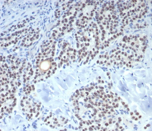 FOXL2 Antibody (FOXL2/7989R) - Azide and BSA Free