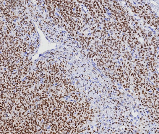 FOXL2 Antibody (FOXL2/7989R) - Azide and BSA Free
