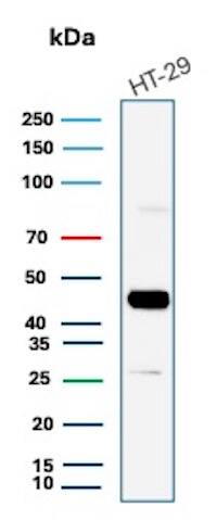 Cytokeratin 20 Antibody (KRT20/7805R) - Azide and BSA Free Western Blot: Cytokeratin 20 Antibody (KRT20/7805R) - Azide and BSA Free [NBP3-20969] -