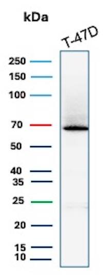 ER alpha/NR3A1 Antibody (ESR1/7444R) - Azide and BSA Free Western Blot: ER alpha/NR3A1 Antibody (ESR1/7444R) - Azide and BSA Free [NBP3-20973] -