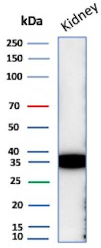Napsin A Antibody (NAPSA/7165R) - BSA Free Western Blot: Napsin A Antibody (NAPSA/7165R) - BSA Free [NBP3-20977] -