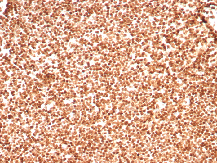 H1F0 Antibody (rHH1/8702) - Azide and BSA Free
