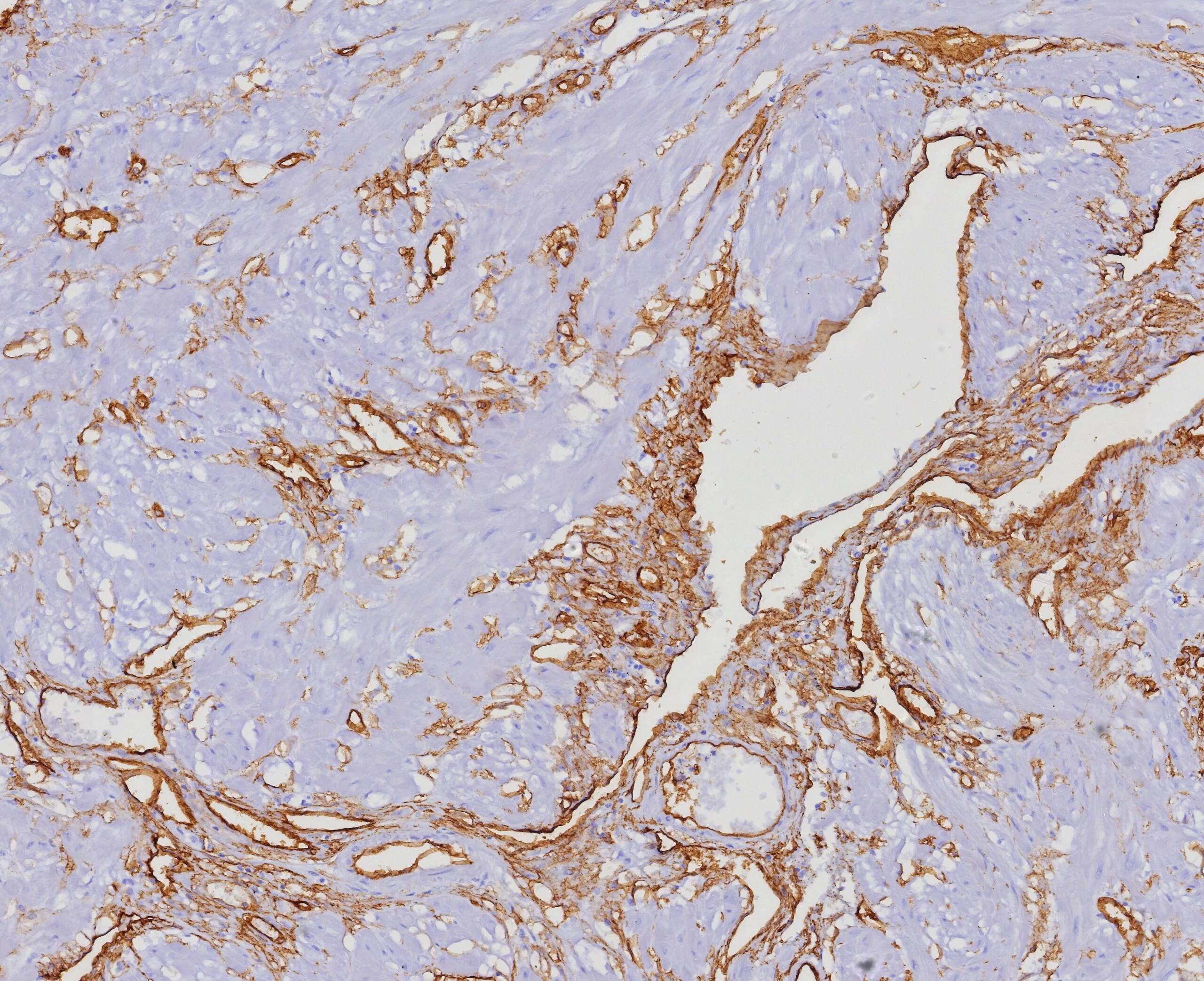 CD34 Antibody (HPCA1/4393R) - Azide and BSA Free Immunohistochemistry-Paraffin: CD34 Antibody (HPCA1/4393R) - Azide and BSA Free [NBP3-20988] -