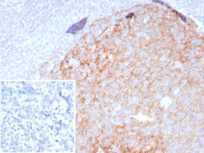 CD23/Fc epsilon RII Antibody (FCER2/8509R) - Azide and BSA Free