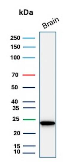 UCH-L1/PGP9.5 Antibody (rUCHL1/8133) - Azide and BSA Free Western Blot: UCH-L1/PGP9.5 Antibody (rUCHL1/8133) - Azide and BSA Free [NBP3-21025] -