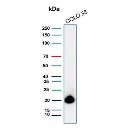Melan-A/MART-1 Antibody (rMLANA/8134) - Azide and BSA Free Western Blot: Melan-A/MART-1 Antibody (rMLANA/8134) - Azide and BSA Free [NBP3-21036] -
